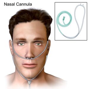Oxygen Nasal Cannula